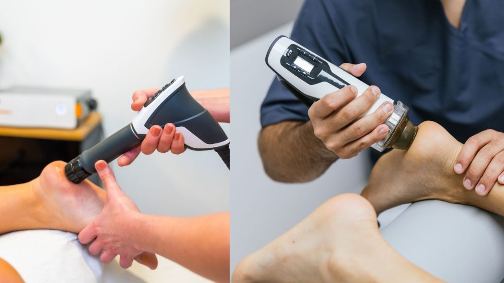 SoftWave therapy for plantar fasciitis treatment targeting heel pain