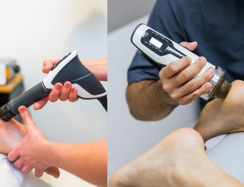 SoftWave Therapy for Plantar Fasciitis